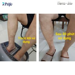 Máy Trị liệu, Chăm Sóc Sức Khỏe 3 IN 1 công nghệ cao ITera – Bio Prife ITeraCare – Coravo