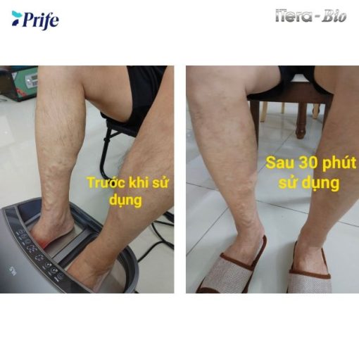 Máy Trị liệu, Chăm Sóc Sức Khỏe 3 IN 1 công nghệ cao ITera – Bio Prife ITeraCare – Coravo