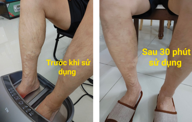 Máy Trị liệu, Chăm Sóc Sức Khỏe 3 IN 1 công nghệ cao ITera – Bio Prife ITeraCare – Coravo